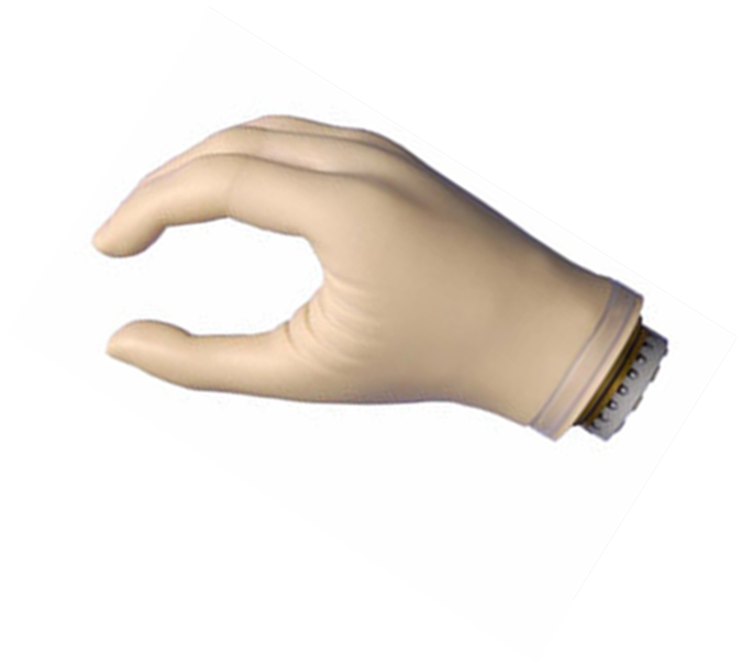 假肢價格廠家教截肢患者正確術后保養(圖1) 假肢價格廠家教截肢患者正確術后保養