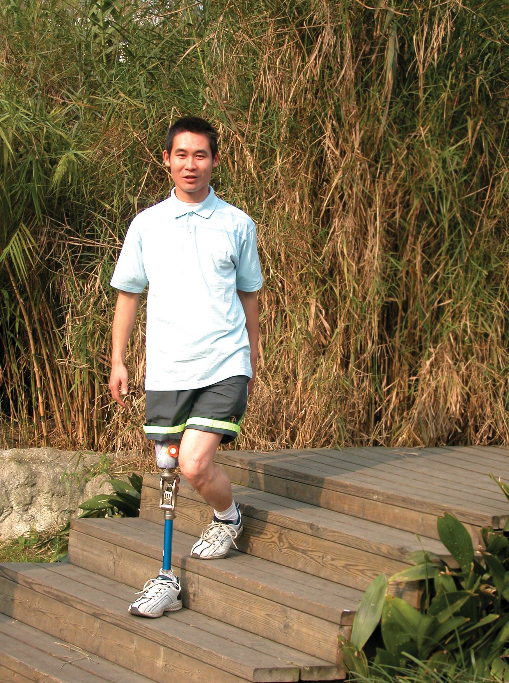 假肢價格便宜的可以選擇嗎？